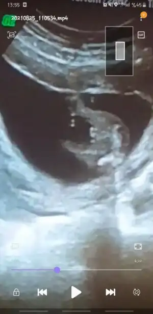 Screenshot_20210825-135521_Video Player.webp