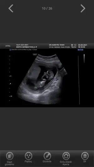 Screenshot_20210904-142829_Hello Mom.webp