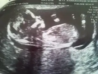 $13 hafta 5 günn.webp