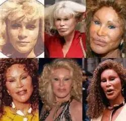 $Jocelyn Wildenstein B & A.img_assist_custom.webp