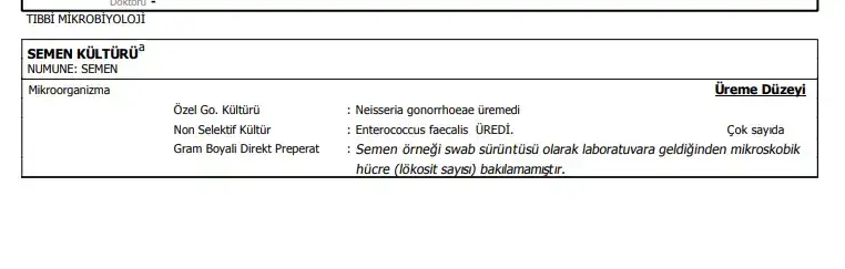 bu teste göre detaylı bakıldı.webp