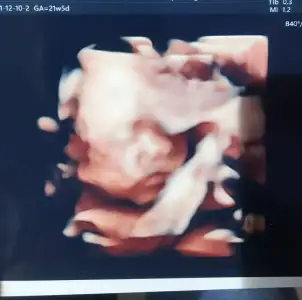 WhatsApp Image 2021-12-10 at 12.44.23.webp