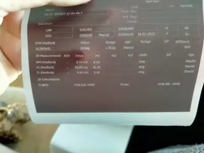 16412964860611040535185921807059.webp