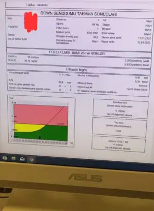 WhatsApp Image 2022-01-12 at 15.55.16.webp