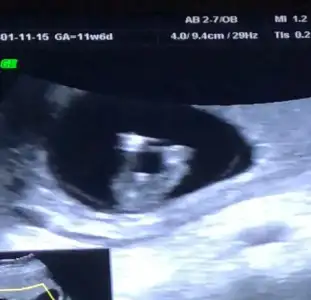 WhatsApp Image 2022-01-17 at 13.42.28.webp