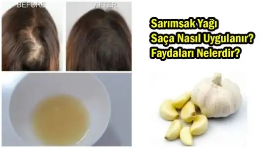 sarimsak_yagi_sac_bakimi.webp