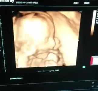 Screenshot_20220219-144942_Gallery.webp