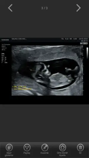 Screenshot_20220305-171521_Hello Mom.webp