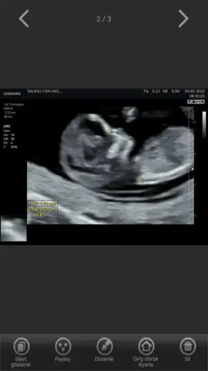 Screenshot_20220305-175124_Hello Mom.webp