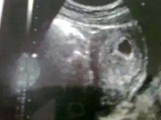 $Gıcık Dünya0433.webp