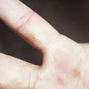 derma 2.webp