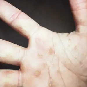 derma 3.webp