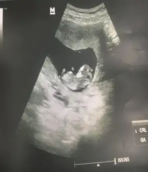 WhatsApp Image 2022-03-16 at 10.08.45.webp