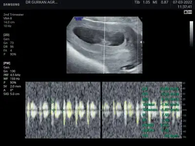 3E02A036-74BF-43ED-8EB8-A4AA72AF229F.webp