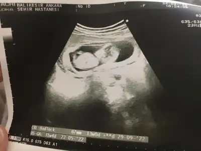 WhatsApp Image 2022-03-25 at 15.09.38.webp