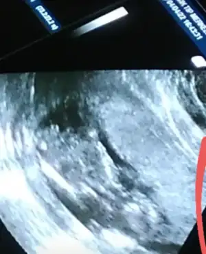 Screenshot_20220404-185415_Video Player.webp