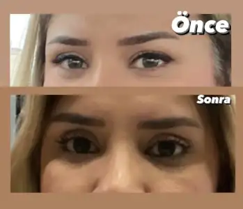 6E47E887-24BE-459A-A4A5-E778FD0C3E51.webp