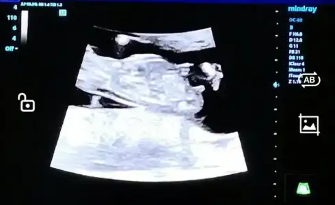 Screenshot_20220514_102634.webp