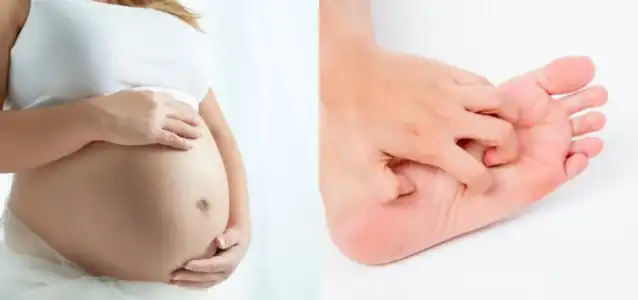 hamilelikte_ayak_kasintisi_gebelik_kolestazi.jpg hamilelikte_ayak_kasintisi_gebelik_kolestazi.jpg