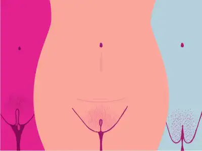 8969-vagina_vulva_female-732x549-thumbnail.webp