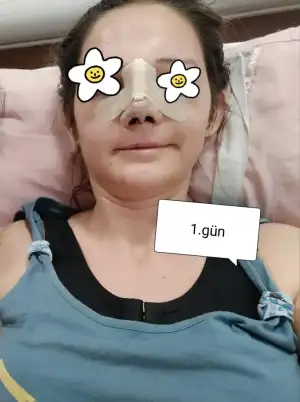 1.gün.webp