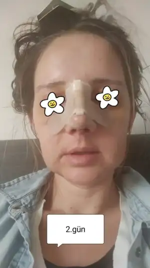 2.gün.webp