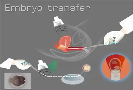 tup_bebekte_embriyo_transferi.webp