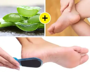 aloe_vera_nasir_tedavisi.webp