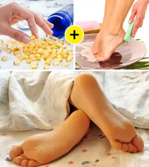 e_vitamin_yagi_nasir_tedavisi.webp