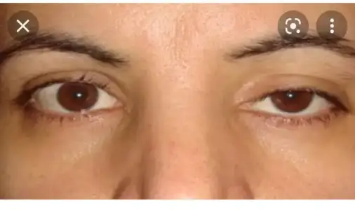 Screenshot_20220731-175237_Google.webp
