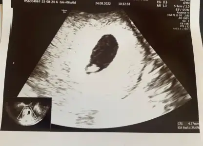 WhatsApp Image 2022-08-29 at 11.02.11.webp