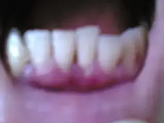 $04072010(002).webp