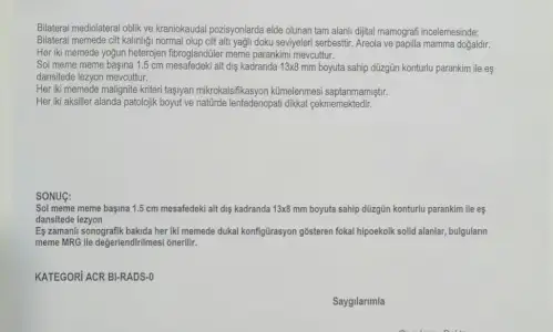 MEMOGRAFİ.webp