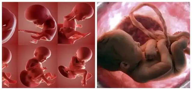 fetal_akciger_gelisimi.jpg fetal_akciger_gelisimi.jpg