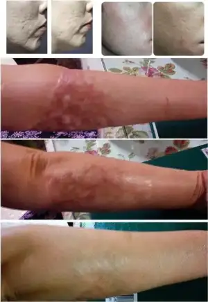 $derma4.webp