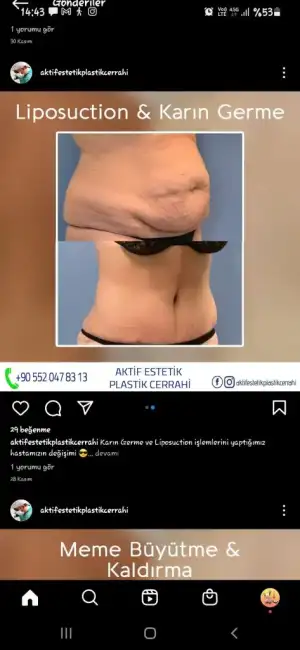 Screenshot_20221214-144338_Instagram.webp