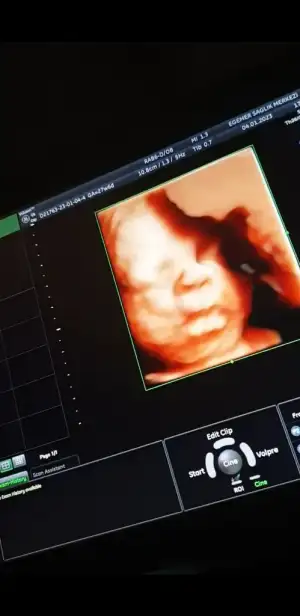 Screenshot_20230104-182558_Photos.jpg Screenshot_20230104-182558_Photos.jpg