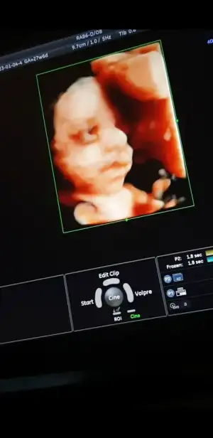 Screenshot_20230104-181937_Photos.jpg Screenshot_20230104-181937_Photos.jpg