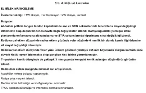 72AE3ED5-538C-4055-89CA-6BA8921DCFE1.webp