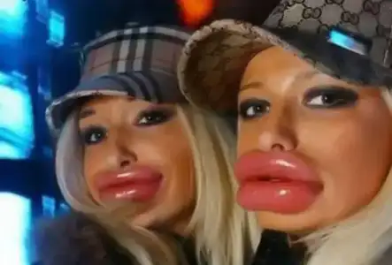 $fatlips.webp
