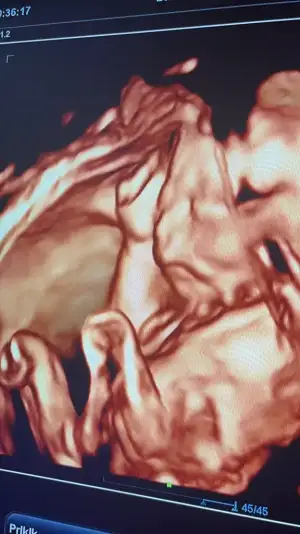 80594687-B8C0-4630-9F1C-6E74F1D396C2.webp