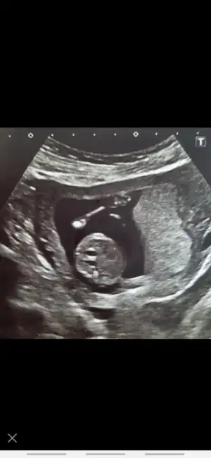 Screenshot_20230209-163045_Elika Pregnant.webp