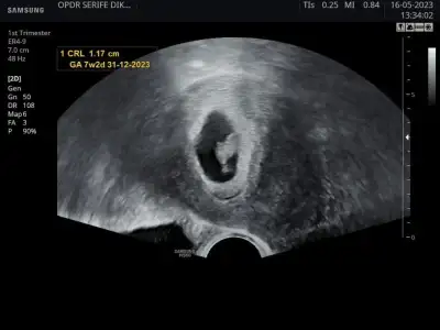 WhatsApp Image 2023-05-16 at 17.19.22.webp