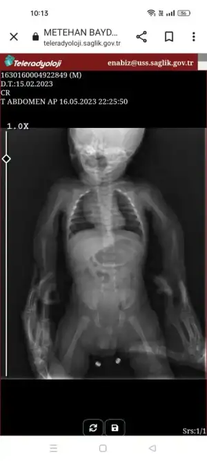 Screenshot_2023-05-17-10-13-31-07_40deb401b9ffe8e1df2f1cc5ba480b12.webp