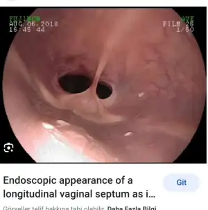 Screenshot_20230525-015210_Google.webp