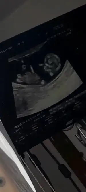 Screenshot_20230617-233153_Video Player.webp