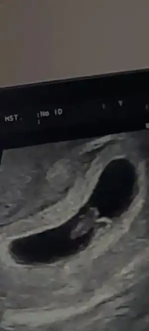 Screenshot_20230619-231050_Video Player.webp