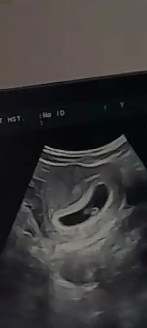 Screenshot_20230619-231037_Video Player.webp