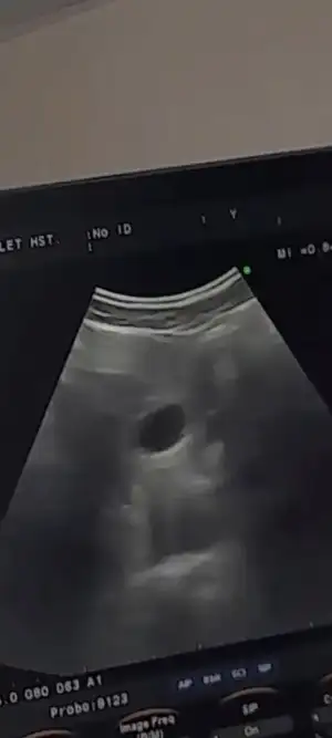 Screenshot_20230619-230807_Video Player.webp