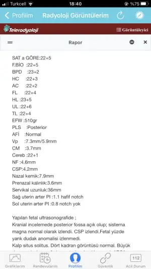 2FB18378-518C-4037-9B48-8E86FE91DA87.webp